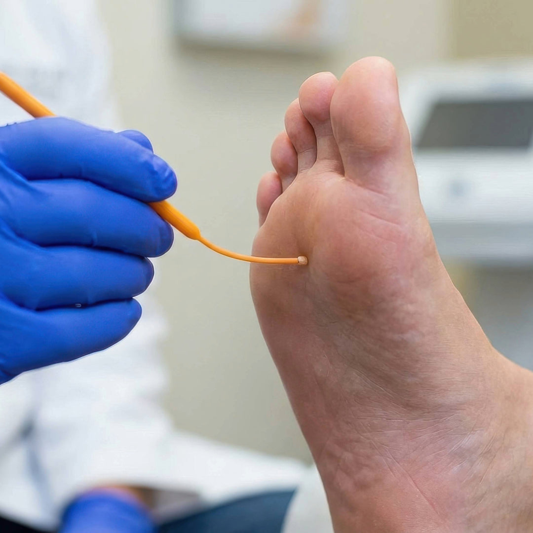 Podiatrist performing a 10-gram monofilament test on the ball of a patient's foot to check for loss of protective sensation