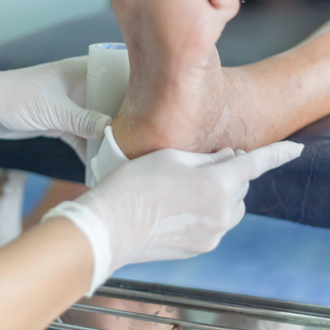 Podiatrist caring for a patient with a diabetic foot ulcer