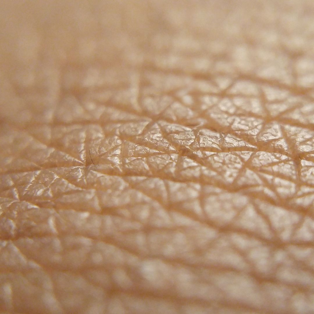 skin barrier repair cream for diabetic feet