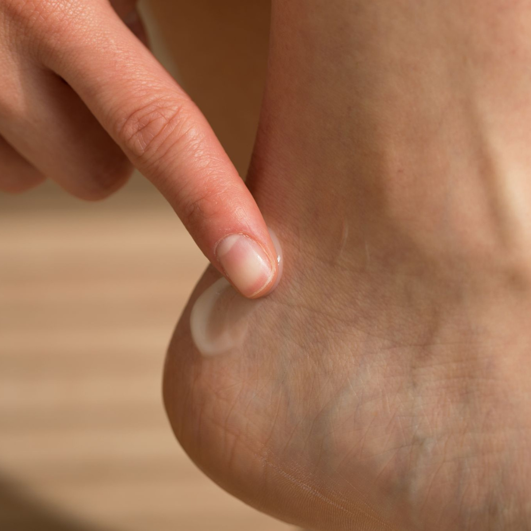 hand applying cream on heel