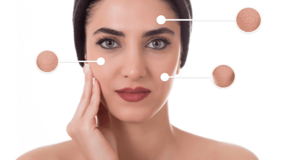 Understanding the comedogenic scale for the best face oil for dry skin