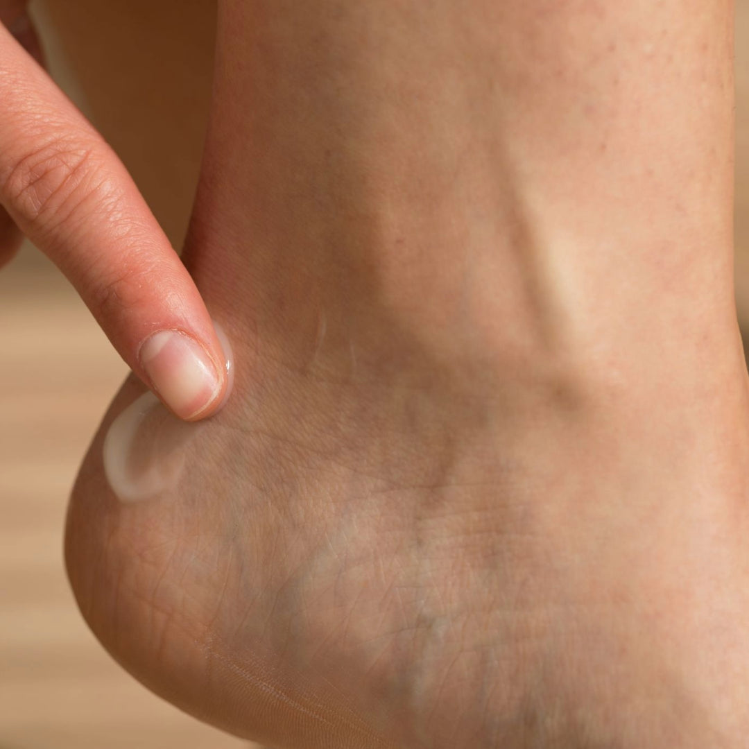 Hand rubbing cream on a heel